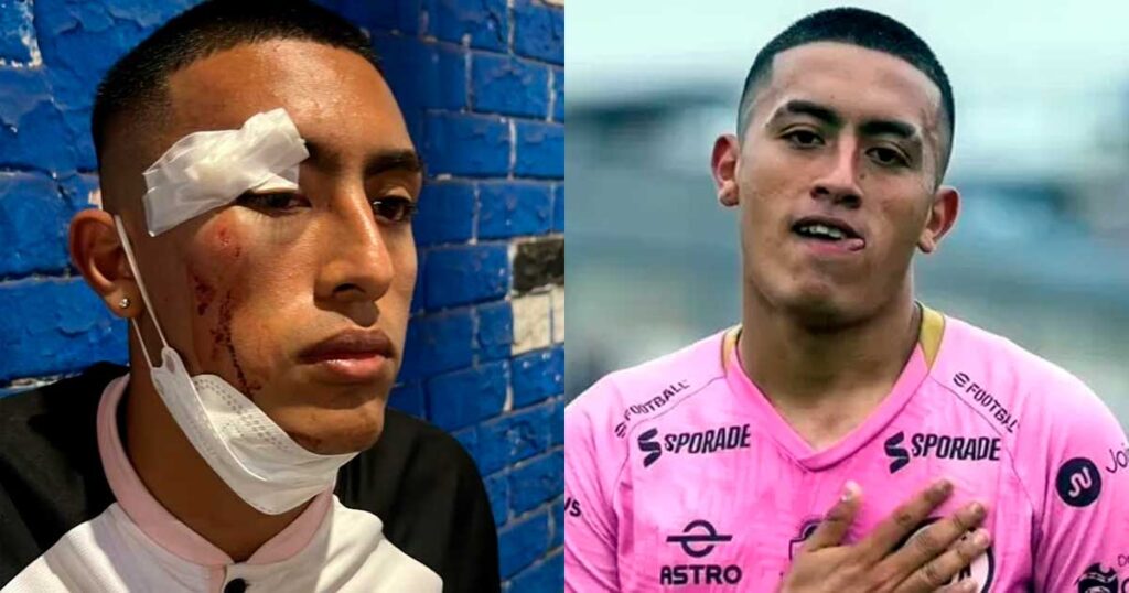 Jugador de Sport Boys fue agredido junto a su familia tras empate con Sporting Cristal