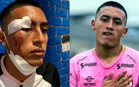 Jugador de Sport Boys fue agredido junto a su familia tras empate con Sporting Cristal