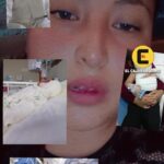 Niño de Cajamarca necesita apoyo tras grave accidente con quemaduras