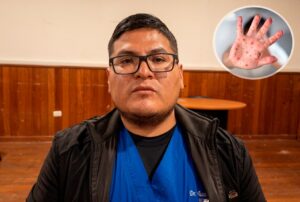 BROTE DE VIRUS COXSACKIE AFECTA A NIÑOS EN OYÓN – RCR Peru