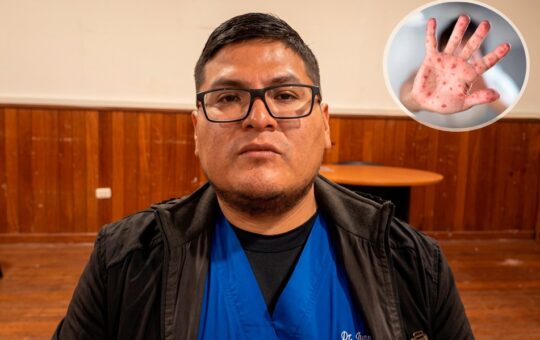 BROTE DE VIRUS COXSACKIE AFECTA A NIÑOS EN OYÓN – RCR Peru