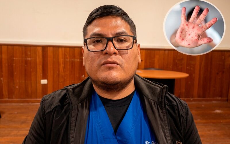 BROTE DE VIRUS COXSACKIE AFECTA A NIÑOS EN OYÓN – RCR Peru