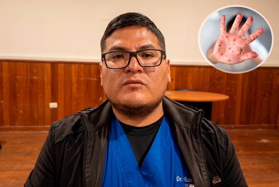 BROTE DE VIRUS COXSACKIE AFECTA A NIÑOS EN OYÓN – RCR Peru