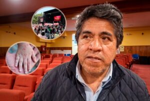 SUBPREFECTURA DE OYÓN ADVIERTE SANCIONES POR INCUMPLIMIENTO DE SUSPENSIÓN DE EVENTOS TRAS BROTE DE VIRUS COXSACKIE – RCR Peru